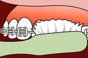 step2