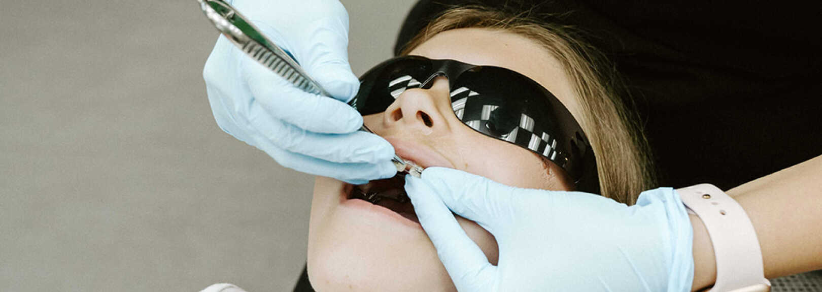 braces life